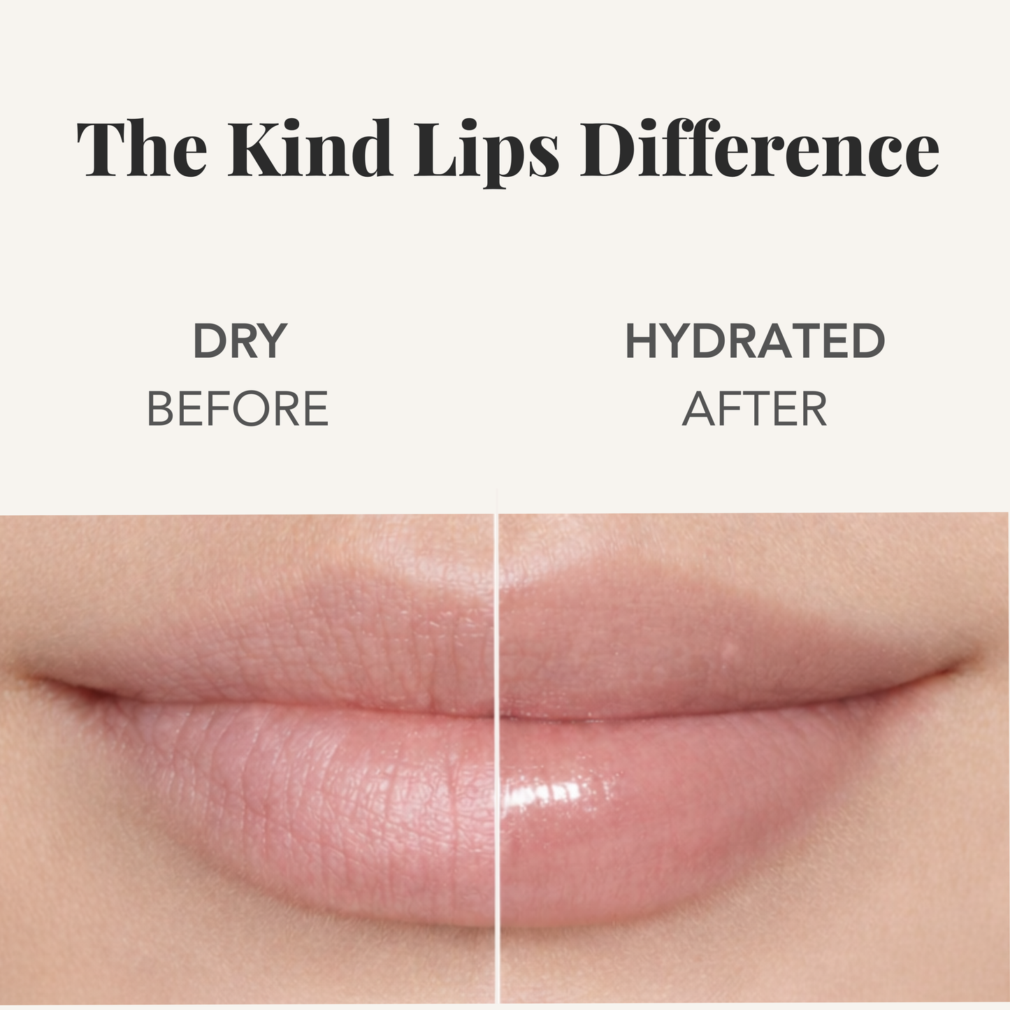 Kind Lips Organic Lip Balm Variety 5 Pack | Multiple Flavors | Made in USA